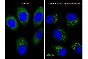 Immunofluorescent analysis of  cells, using LC3 Antibody (G8B) (N-term) 1802a. (MAP1LC3A 抗体  (N-Term))