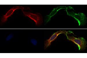 ABIN6263304 and ABIN6266596 staining Hela by IF/ICC. (MMP3 抗体  (C-Term))