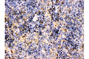 Immunohistochemistry (Paraffin-embedded Sections) (IHC (p)) image for anti-Tribbles Pseudokinase 2 (TRIB2) (AA 175-211), (Middle Region) antibody (ABIN3044555)
