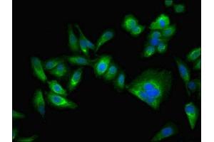 Immunofluorescent analysis of Hela cells using ABIN7146715 at dilution of 1:100 and Alexa Fluor 488-congugated AffiniPure Goat Anti-Rabbit IgG(H+L) (CA2 抗体  (AA 2-260))