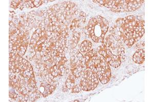 IHC-P Image Immunohistochemical analysis of paraffin-embedded SW480 xenograft, using ret finger protein, antibody at 1:100 dilution. (TRIM27 抗体)