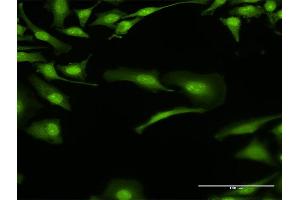 Immunofluorescence of purified MaxPab antibody to BOLL on HeLa cell. (BOLL 抗体  (AA 1-295))