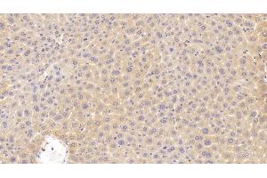 Detection of CDKN2B in Mouse Liver Tissue using Polyclonal Antibody to Cyclin Dependent Kinase Inhibitor 2B (CDKN2B)