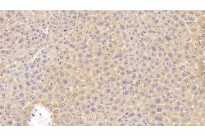 Detection of CDKN2B in Mouse Liver Tissue using Polyclonal Antibody to Cyclin Dependent Kinase Inhibitor 2B (CDKN2B) (CDKN2B 抗体  (AA 1-130))
