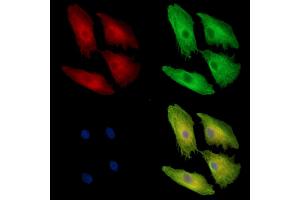 ABIN7097092 and ABIN7101159 staining  cells by IF/ICC.