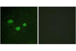 Immunofluorescence analysis of HeLa cells, using DNMT3B Antibody. (DNMT3B 抗体  (AA 1-50))