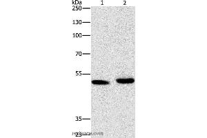 Western blot analysis of 231 cell and human liver cancer tissue, using ATG4A Polyclonal Antibody at dilution of 1:300 (ATG4A 抗体)