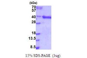 SDS-PAGE (SDS) image for Hepatoma Derived Growth Factor-Like 1 (HDGFL1) (AA 1-251) protein (His tag) (ABIN6387512) (HDGFL1 Protein (AA 1-251) (His tag))