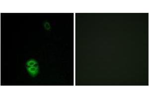 Immunofluorescence analysis of A549 cells, using OR4K17 Antibody. (OR4K17 抗体  (AA 263-312))