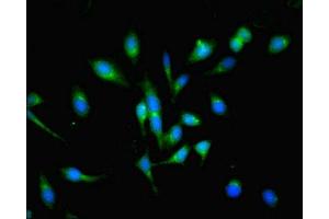 Immunofluorescent analysis of Hela cells using ABIN7163729 at dilution of 1:100 and Alexa Fluor 488-congugated AffiniPure Goat Anti-Rabbit IgG(H+L) (POGK 抗体  (AA 101-400))