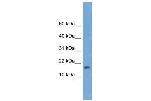 WB Suggested Anti-C14orf129 Antibody Titration: 0. (GSKIP 抗体  (Middle Region))