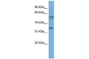 FNDC8 antibody used at 0. (FNDC8 抗体  (N-Term))