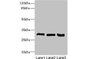Western blot All lanes: KHKantibody at 3. (Ketohexokinase 抗体  (AA 1-298))