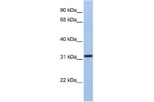 SLC25A28 antibody used at 1 ug/ml to detect target protein. (SLC25A28 抗体  (C-Term))