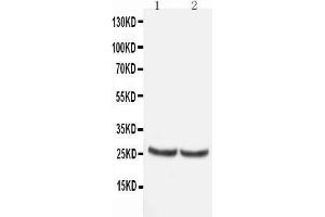 Anti-TIMP4 antibody, Western blotting All lanes: Anti TIMP4  at 0. (TIMP4 抗体  (C-Term))