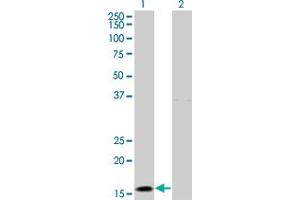 Western Blot analysis of IFNA2 expression in transfected 293T cell line by IFNA2 monoclonal antibody (M28), clone 1B4. (IFNA2 抗体  (AA 24-188))