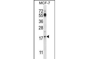 SSSCA1 Antibody (N-term ) (ABIN657577 and ABIN2846581) western blot analysis in MCF-7 cell line lysates (35 μg/lane). (SSSCA1 抗体  (N-Term))