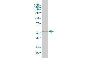 PGAM1 monoclonal antibody (M01), clone 2G1-A6 Western Blot analysis of PGAM1 expression in Jurkat . (PGAM1 抗体  (AA 1-254))