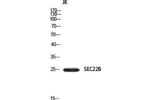 Western Blot (WB) analysis of JK using SEC22B antibody. (SEC22B 抗体)