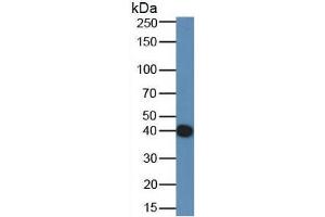 Western Blotting (WB) image for Complement 4 (C4) ELISA Kit (ABIN6574234)