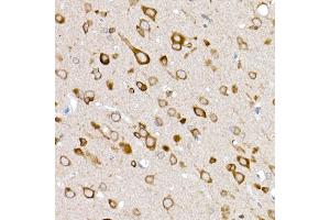 Immunohistochemistry of paraffin-embedded rat brain using GLUT3/SLC2 Rabbit pAb (ABIN6134111, ABIN6147961, ABIN6147962 and ABIN6224173) at dilution of 1:50 (40x lens). (SLC2A3 抗体  (AA 150-250))