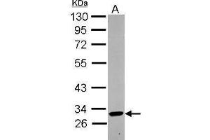 WB Image Sample (30 ug of whole cell lysate) A: THP-1 10% SDS PAGE antibody diluted at 1:1000 (KIR2DL4/CD158d 抗体  (Center))