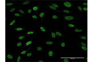 Immunofluorescence (IF) image for anti-AF4/FMR2 Family, Member 4 (AFF4) (AA 1-365) antibody (ABIN525854)