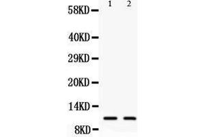 Anti-Eotaxin3 antibody, Western blotting All lanes: Anti Eotaxin3  at 0. (CCL26 抗体  (C-Term))