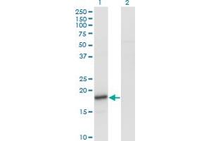 Western Blot analysis of SNCA expression in transfected 293T cell line by SNCA monoclonal antibody (M01), clone 2E4. (SNCA 抗体  (AA 31-140))