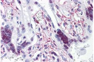 Human Placenta: Formalin-Fixed, Paraffin-Embedded (FFPE) (ATR 抗体  (AA 2545-2645))