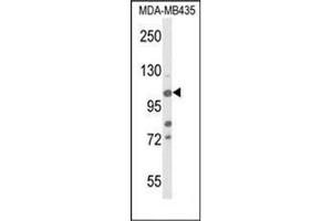 Western blot analysis of Phospho-JMJD2B-pT305 in MDA-MB435 cell line lysates (35ug/lane).