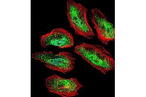 Fluorescent confocal image of Hela cell stained with TSN Antibody (Center) (ABIN656310 and ABIN2845612). (Translin 抗体  (AA 109-138))