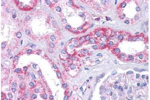 Human Kidney: Formalin-Fixed, Paraffin-Embedded (FFPE) (SIPA1L1 抗体  (N-Term))