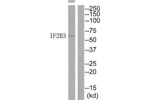 Western Blotting (WB) image for anti-Insulin-Like Growth Factor 2 mRNA Binding Protein 3 (IGF2BP3) (N-Term) antibody (ABIN1848922) (IGF2BP3 抗体  (N-Term))