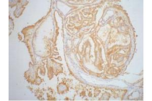Immunohistochemistry (IHC) staining of Human thyroid tissue paraffin-embedded, diluted at 1:200. (Galectin 3 抗体)