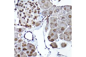 Immunohistochemistry (IHC) image for anti-SEC14-Like 2 (SEC14L2) (AA 60-270) antibody (ABIN6147484)