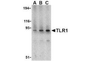 Image no. 1 for anti-Toll-Like Receptor 1 (TLR1) (N-Term) antibody (ABIN951276) (TLR1 抗体  (N-Term))