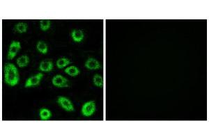 Immunofluorescence (IF) image for anti-ATP synthase subunit delta, mitochondrial (ATP5F1D) (Internal Region) antibody (ABIN1850818) (ATP5F1D 抗体  (Internal Region))