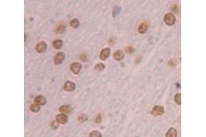 Immunohistochemistry (IHC) image for anti-Nuclear Receptor Subfamily 4, Group A, Member 3 (NR4A3) (AA 29-145) antibody (ABIN1869486)