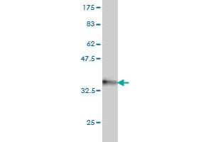 Western Blot detection against Immunogen (31. (HOXA7 抗体  (AA 58-112))