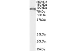 Western Blot using anti-CD155 antibody 3F1. (Recombinant Poliovirus Receptor 抗体)