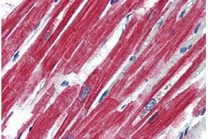 Human Heart (formalin-fixed, paraffin-embedded) stained with LEPR antibody ABIN364407 at 4 ug/ml followed by biotinylated anti-goat IgG secondary antibody ABIN481715, alkaline phosphatase-streptavidin and chromogen. (Leptin Receptor 抗体  (AA 829-841))