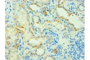 Immunohistochemistry of paraffin-embedded human kidney tissue using ABIN7144142 at dilution of 1:100 (SLC4A2 抗体  (AA 95-245))