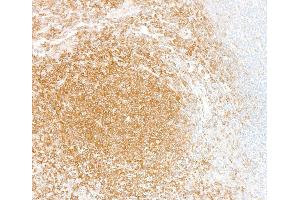Immunohistochemistry (IHC) image for anti-Nuclear Factor-kB p65 (NFkBP65) (C-Term) antibody (ABIN7795799) (Recombinant NF-kB p65 抗体  (C-Term))