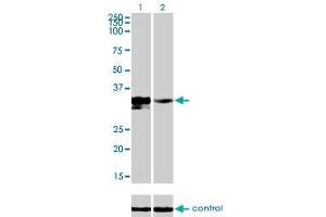 Western blot analysis of DLX3 over-expressed 293 cell line, cotransfected with DLX3 Validated Chimera RNAi (Lane 2) or non-transfected control (Lane 1). (DLX3 抗体  (AA 1-287))