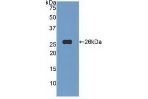 Detection of Recombinant TNFSF14, Human using Polyclonal Antibody to Tumor Necrosis Factor Ligand Superfamily, Member 14 (TNFSF14) (TNFSF14 抗体  (AA 62-240))