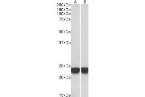 ABIN184951 (0. (PARK7/DJ1 抗体  (C-Term))