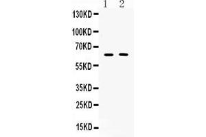 Western blot analysis of TUB 1 expression in COLO320 whole cell lysates ( Lane 1) and MCF-7 whole cell lysates ( Lane 2). (TUB 抗体  (C-Term))