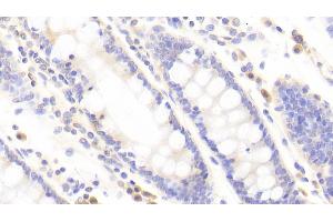 Detection of TJP2 in Human Colon Tissue using Polyclonal Antibody to Tight Junction Protein 2 (TJP2) (TJP2 抗体  (AA 307-669))