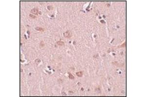 Immunohistochemistry of FAM59A in human liver tissue with this product at 5 μg/ml. (PLEKHM2 抗体  (C-Term))